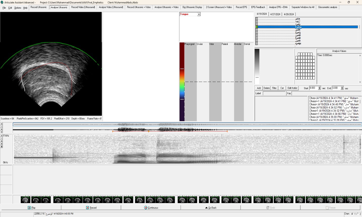 Articulate Assistant Advanced interface showing an ultrasound tongue contour and aligned acoustic signal